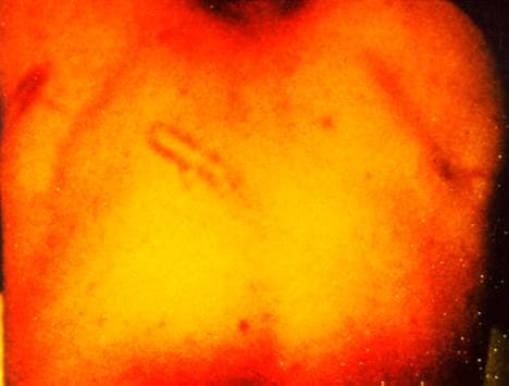 Resim 1
